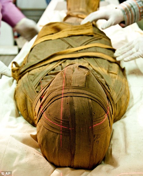 أبحاث علمية وأثرية تؤكد أن المصريين القدماء عرفوا أمراض القلب